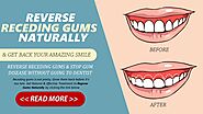 Reverse Receding Gum