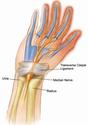 Wrist Pain - Associated Conditions