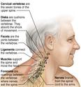Causes And Treatments Of Neck Muscle Pain And Pain In The Top Of The Wrist