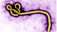Second Person in U.S. Contracts Ebola Virus