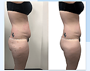 How can I make my fat body sculpting look thinner in photos?