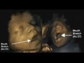 Fetus yawning reveals brain development - CBS News