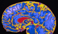 Childhood stimulation key to brain development, study finds | Science | The Guardian