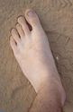 Elevation Causes Foot Pain