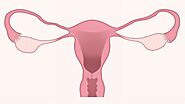 What Is Cervical Cancer?