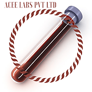 Non Vacuum Blood Collection Tube Manufacturers
