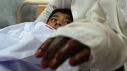 An Injured Student Lies in Bed at a Peshawar Hospital