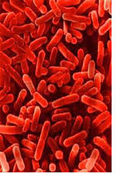 Red Pigmented Salinibacter ruber