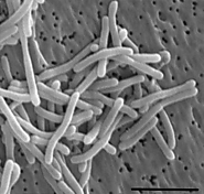 Salinibacter ruber Morphology- Gram negative, Rod Shaped bacteria