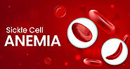What is Sickle Cell Anemia? Know Symptoms, Causes, and More