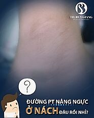 Nâng ngực nội soi đường nách là gì? Có nên chọn đường nách