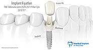 Website at https://www.implantdental.gen.tr/implant-fiyatlari.html