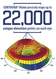 Contoura Vision LASIK Results Achieved | Freedom Eye Laser — Freedom Eye Laser
