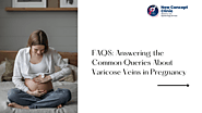 FAQS: Answering the Common Queries About Varicose Veins in Pregnancy