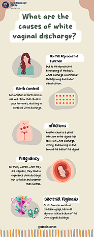 What Are The Causes of White Vaginal Discharge?
