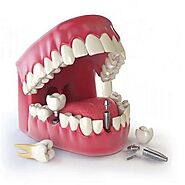 Dental Implants Cost in Dubai UAE & Abu Dhabi | Cheapest Price