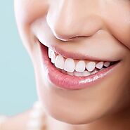 Dental Tooth Bonding & Cementing in Dubai