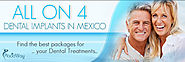 Dental Implants Options in Mexico| Dental Treatment | Implants | Dentistry | Dentures | Dental Clinics Mexico