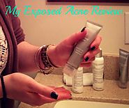 My Exposed Acne Treatment Review After 4 Weeks