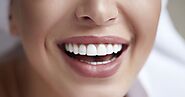 5280 Teeth Whitening - Laser Teeth Whitening Solution