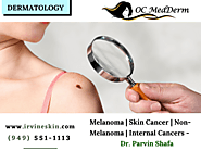 Skin Cancer Treatment in Orange County | Dr. Parvin Shafa