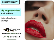 Lip Fillers in Irvine, California