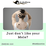 Mole removal with Dr. Parvin Shafa at OC MedDerm Dermatology