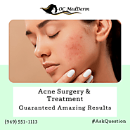 Scar Treatment Specialist - Irvine, CA