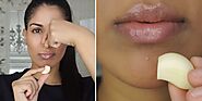 Can Raw Garlic Really Get Rid Of Pimples Instantly? | SELF