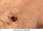 bed bug on skin