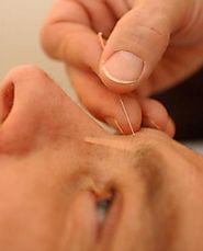 Hvad ved vi om effekten af akupunktur?