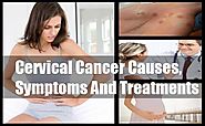 Cervical Cancer Symptoms, Causes and Treatments