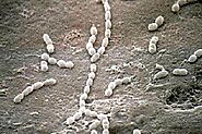 Streptococcus thermophilus - microbewiki