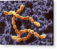 Streptococcus Thermophilus Health Benefits + Precautions.