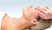 Acupuncture For Acne | Prevention