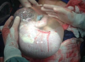SEE this veiled birth, baby born in amniotic sac (WARNING GRAPHIC IMAGE)