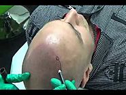 Get All You Want To Know About Scalp Micro Pigmentation