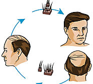 Have Proper Amount of Iron And Get Rid From Hair Loss