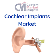 Global Cochlear Implants Market Size, Share, Growth, Share 2030