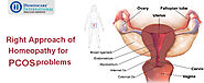 PCOS treatment in Homeopathy | Homeopathy treatment for PCOS