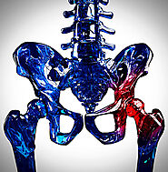 Website at https://www.removemypain.com/joint-and-musculoskeletal-pain.html