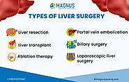 Best Liver Surgery In Chennai | 100% Best Liver Surgeon