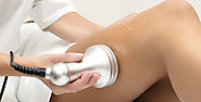 Laser Hair Removal -One of the Most Popular Laser Treatments (with image) · shezay