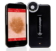 Handyscope dermatoskop