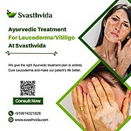 Ayurvedic Treatment For Leucoderma/Vitiligo at Svasthvida