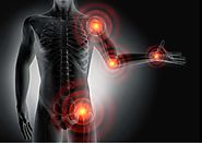 CRPS Solicitors (Complex Regional Pain Syndrome)