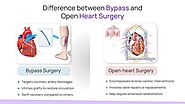 Difference between Bypass and Open Heart Surgery ?