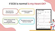 If ECG is normal is my heart ok?