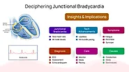 Deciphering Junctional Bradycardia: Insights & Implications