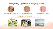 Healing Stories: Navigating Open Heart Surgery Scars -